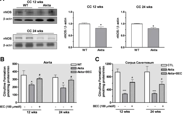 Figure S1 Increased Arginase Activity in Liver and Kidney from Akita Mice. Increased arginase activity was observed in liver (at 12 and 24 wks of age) and kidney (4, 12 and 24 wks of age) from Akita compared with those of age matched WT mice (panel A and B
