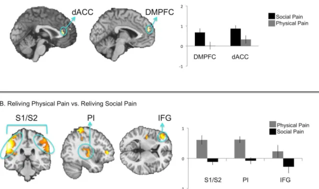 Fig 6. A. Direct comparison of social pain reliving versus physical pain reliving. B. Direct comparison of physical pain reliving versus social pain reliving.