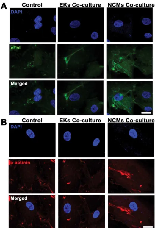 Figure 4. Immunostaining of cardiac specific proteins in ESCMs at day 20 of differentiation
