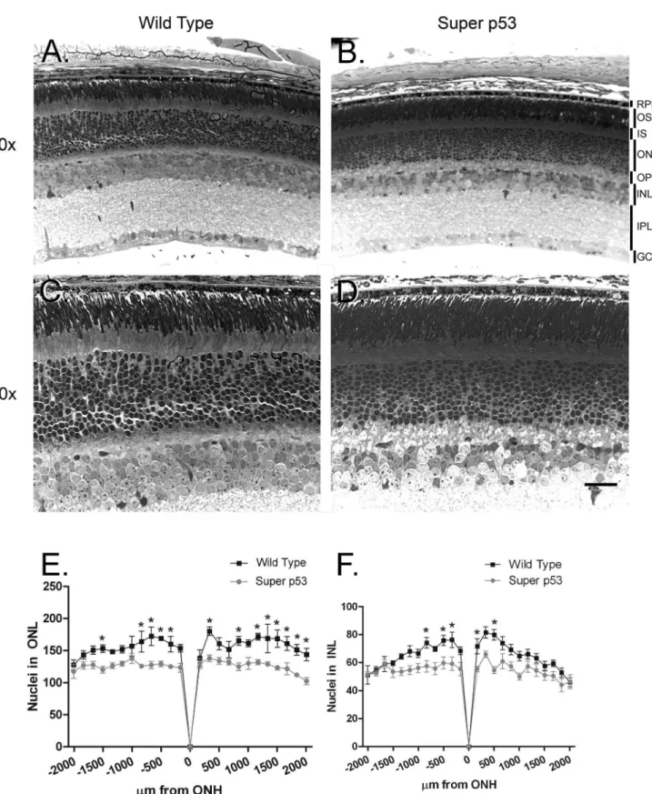 Figure 2. Histologic examination of super p53 retina. Light micrographs of retinal cross-sections taken from Wild Type (A&amp;C) and Super p53 (B&amp;D) mice