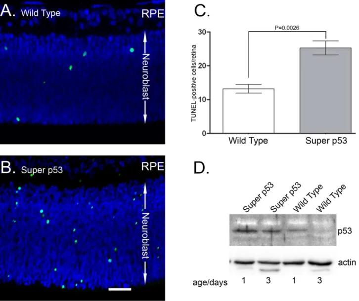 Figure 3. TUNEL labeling of cross sections of P1 retina. TUNEL labeling showed increased apoptotic death in the neuroblastic layer (NBL) of P1 super p53 mice (B) when compared to wt retinas (A)