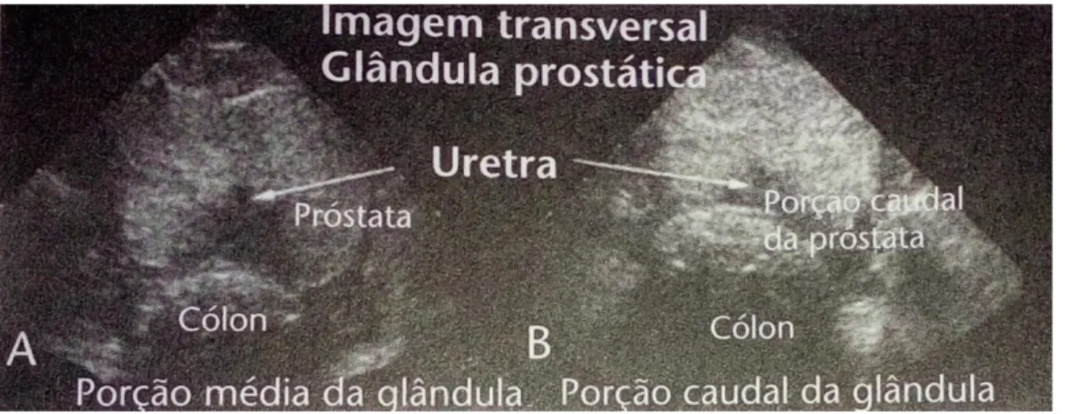 Figura 5: fotografia da próstata de cão através do exame ultrassonográfico. 