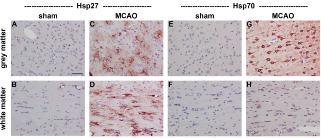 Fig. 1. Representative images of Hsp27 and Hsp70 expression in rat brain after transient MCAO