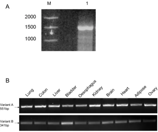 Figure 2. Expression of splice variants of ZnT5 detected by RT-PCR. (A) Variant B is a genuine transcript of the ZnT5 gene