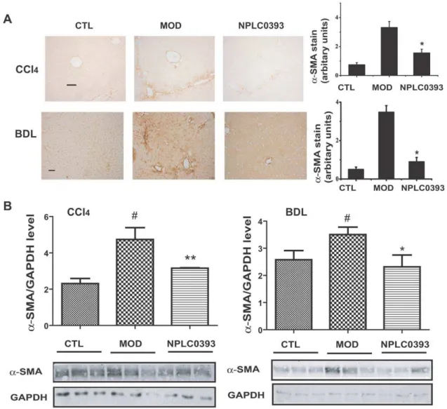 Figure 6. NPLC0393 attenuated CCl 4 - and BDL-induced a-SMA expressions in vivo . (A) Expression of a-SMA in CCl 4 - and BDL-intoxicated mice was evaluated by immunohistochemical staining, and quantified by counting five random chosen high-power fields