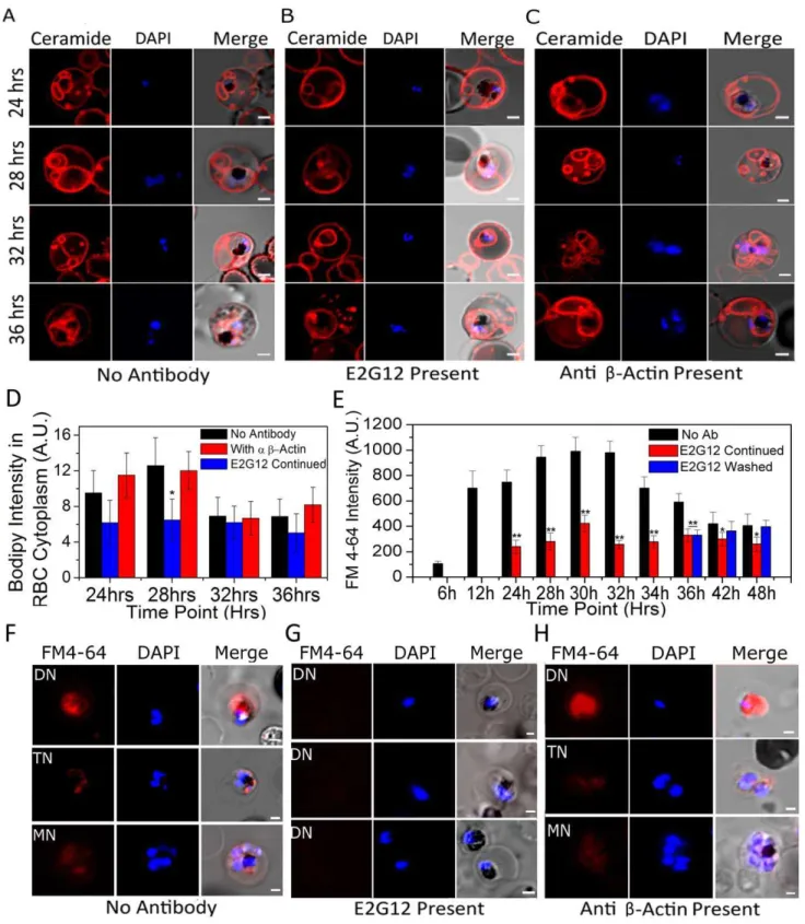 Figure 6. BODIPY-ceramide and FM4-64 staining of live infected erythrocytes in the presence and absence of anti-P2 mAb E2G12.