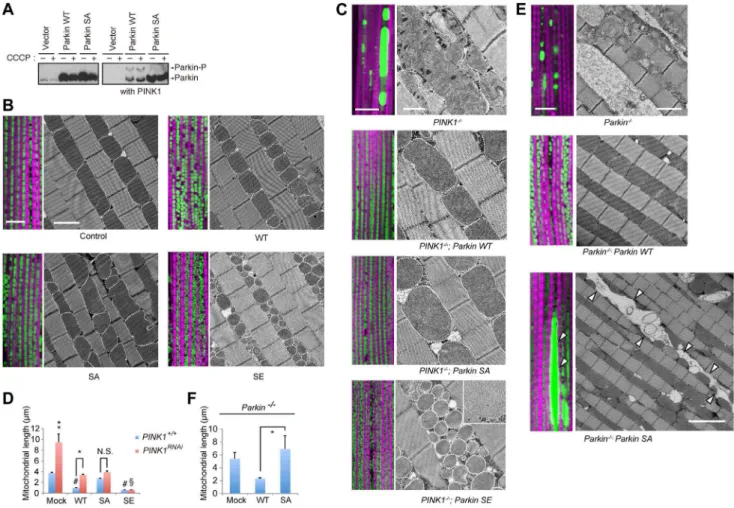 Figure 1. Phosphorylation of the Parkin Ubl domain regulates mitochondrial morphology