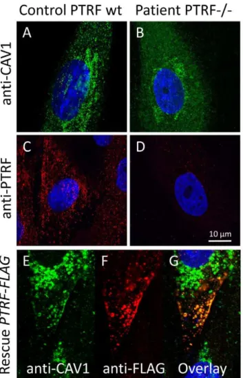 Figure 6. Cell-biological consequences of PTRF-CAVIN deple- deple-tion. (A) Confocal microscopic image of the punctate distribution of caveolin-1 which labels the caveolae on the surface of a fibroblast