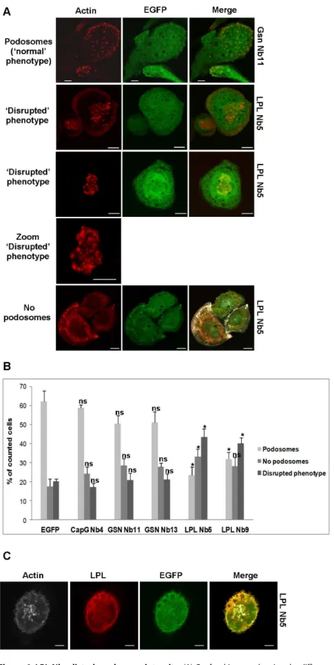 Figure 6. LPL Nbs disturb podosome integrity. (A) Confocal images showing the different phenotypes, observed in THP-1 macrophages