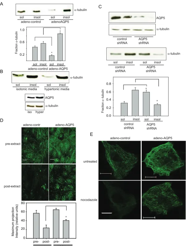 Figure 2. Molecular manipulation of AQP5 altered the MT soluble fraction. A. Transduction of adeno-AQP5 in 16HBE cells led to a significant decrease in soluble tubulin fraction