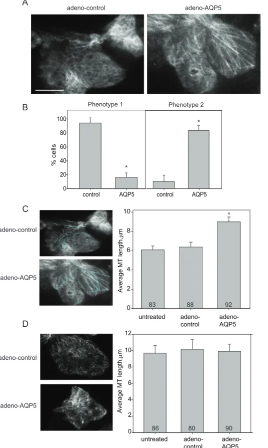 Figure 6. Total internal reflection fluorescence (TIRF) imaging showed that AQP5 altered MT structure at apical surfaces
