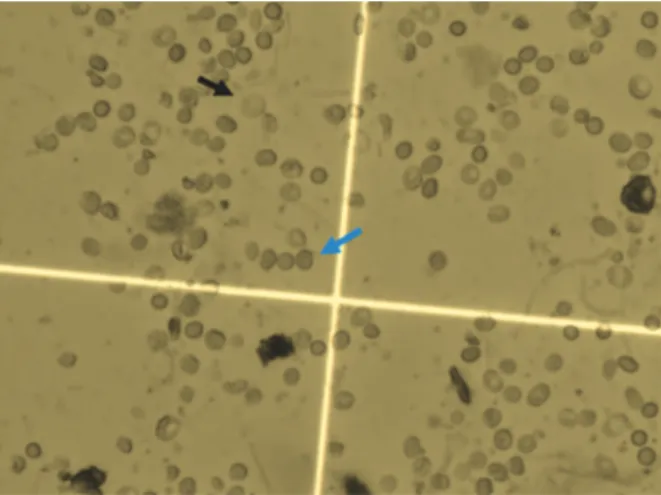 Fig 1: Viable (black arrow) and non-viable (blue arrow)  periodontal cells labeled by trypan blue under light  microscope  (×400).
