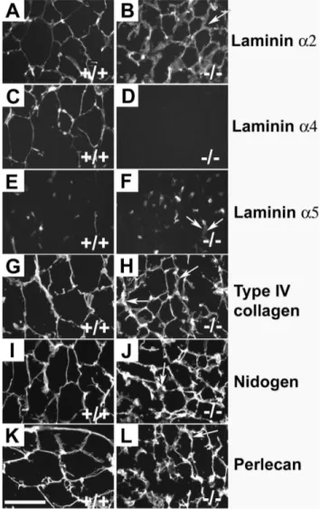 Figure 1. Immunostaining of WAT. The capillaries and BMs of adipocytes of wild-type control and Lama4Lama4 2 / 2 mice were positive with antibodies against laminin a2 (A, B)