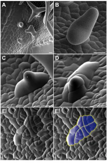 Figure 5. Morphology of aborted trichomes. Scanning electron micrographs of rosette leaves of wild-type plants (A,B) and plants expressing PRO GL2 :ICK1/KRP1 (C–E)