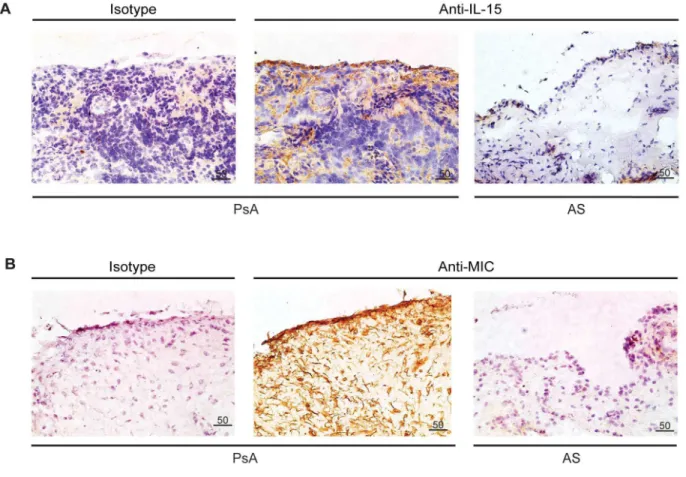 Figure  S1.    cPLA2  function  is  comparable  between  NKL cells  and  NK  clones.  (A)  cPLA2  is  phosphorylated  in response to NKG2D in NK clones