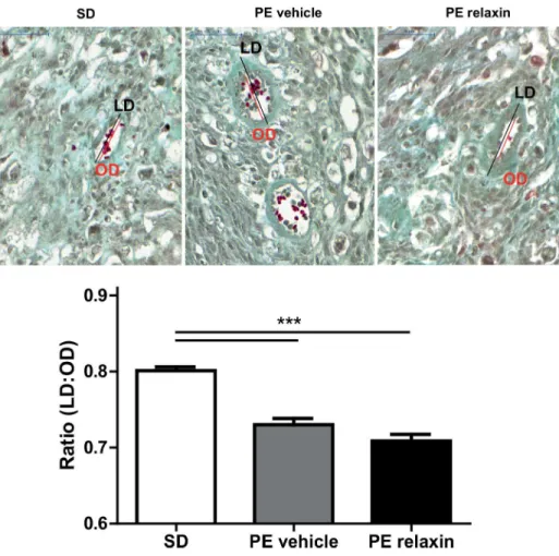 Fig 6. Effect of relaxin on spiral artery remodeling. Representative images of Masson Trichome-stained uteroplacental unit sections of SD, vehicle and relaxin treated PE rats at gestational day 21
