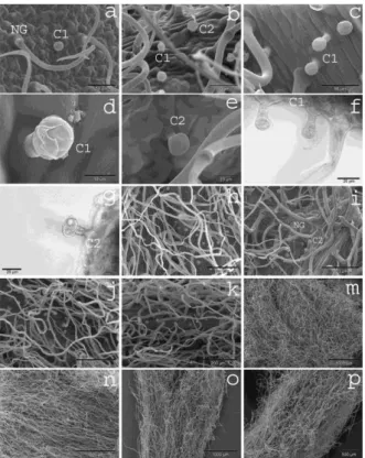 Figure 1. SEM micrographs of the different types of trichomes of Stachys iva (b, c, d, e, h, i, o) and S