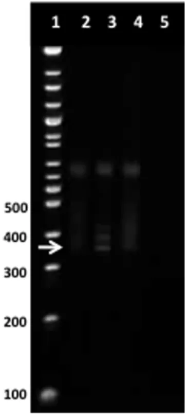 Figure 2. Clonal Vc9 rearrangement in cd + T-cells. Example of Vd2Jc9 clonality detection in patient number 4 (Table 1)