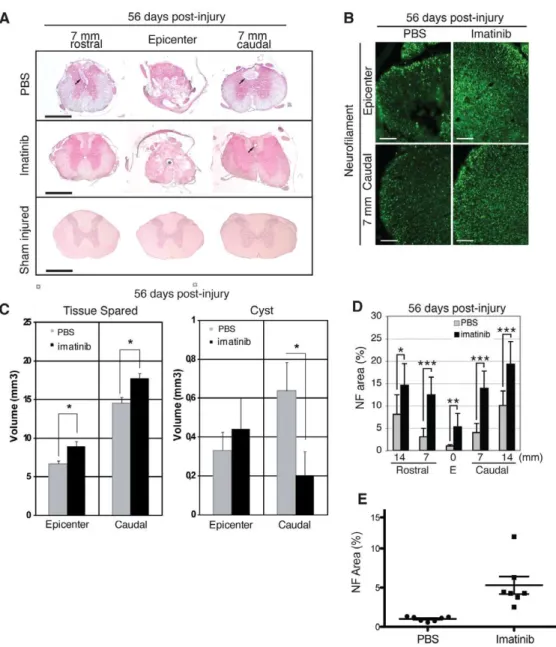 Fig. 5 B-E, Fig. S6). CS56 and NG2 immunoreactivities within theFigure 2. Imatinib enhances tissue preservation.H&amp;E staining was used to visualize tissue and spinal cysts within the epicenter and in spinalsegments 7 and 14 mm rostral and caudal to the 