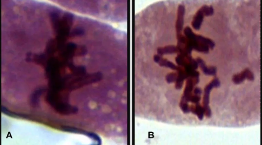 Figura 1: Metáfases mitóticas de Pisum sativum, mostrando metáfase normal (A) e metáfase anormal com  cromossomo isolado (B)