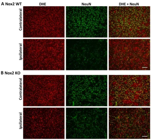 Figure 3. Immunofluorescent co-localisation of ROS generation with NeuN at 24 h. Representative fluorescent micrographs of ROS- ROS-sensitive DHE, the neuronal antibody NeuN and merged images from the contralateral and ipsilateral core striatum of Nox2 WT 