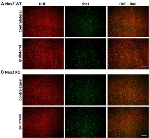 Figure 6. Immunofluorescent co-localisation of ROS generation with Iba1 at 24 h. Representative fluorescent micrographs of ROS-sensitive DHE, the macrophage/activated microglia antibody Iba1 and merged images from the contralateral and ipsilateral penumbra