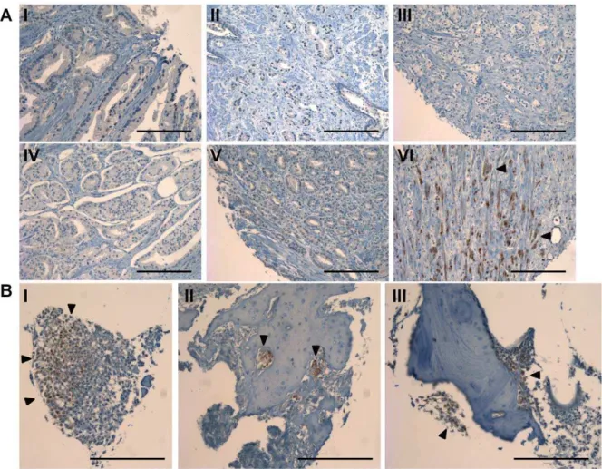 Figure 8. Quantification of phospho-Erk immunohistochemis- immunohistochemis-try. The mean score plotted for each group taken from two blinded investigators (black circles)
