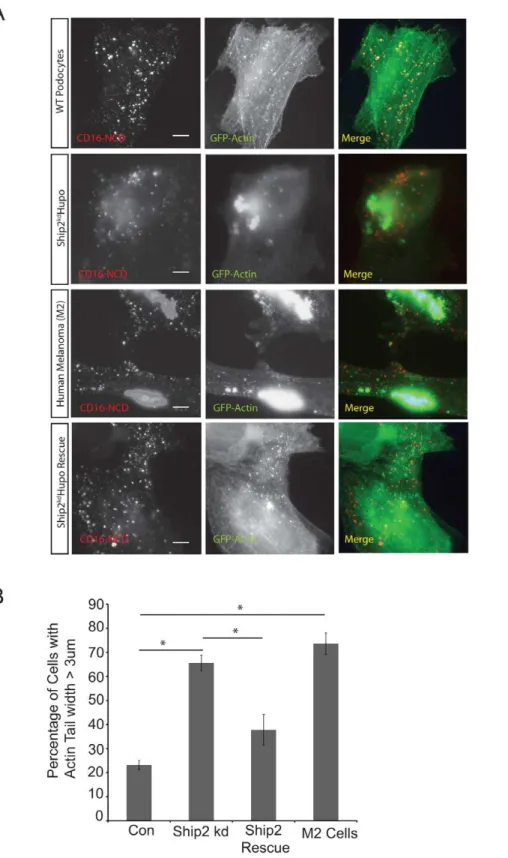 Figure 7. Ship2 knock down and lack of Filamin results in aberrant actin tails. A. Human podocytes WT or Ship2 kd Hupo expressing the indicated plasmids were clustered as described and examined using confocal microscopy