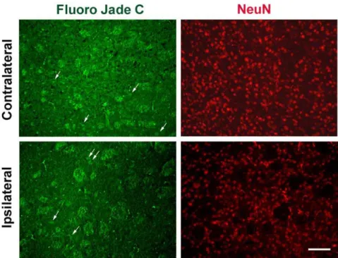 Figure 4. Probe insertion does not cause significant cell loss in mouse striatum. Coronal striatal sections obtained after microdialysis stained for the presence of degenerating neurons with the fluorescent dye, Fluoro-jade c (A and C)