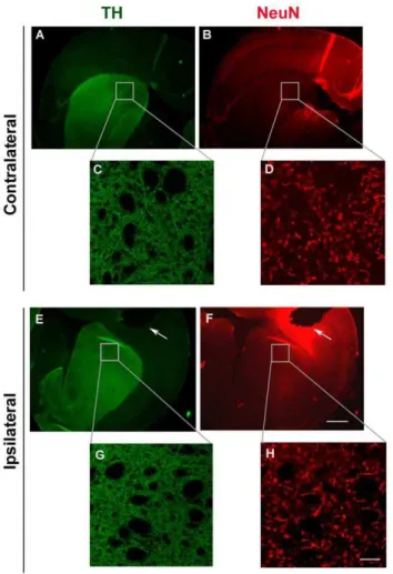 Figure 5. Striatal neuronal fiber density is not affected by probe placement. Representative coronal sections showing the side of probe insertion (ipsilateral side, E-H) and the opposite, control side (contralateral side, A–D)