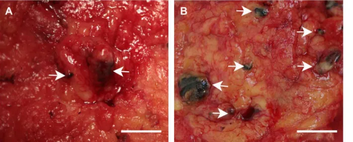 Fig 1. A Black-dyed lymph nodes (as indicated by arrows) were visible 1 day after injection of carbon nanoparticles