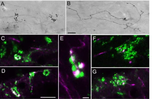 Figure 1. Convergence of tectopulvinar terminals. Injections of biotinylated dextran amine (BDA) in the SC labels tectopulvinar axons that form widespread (‘‘diffuse’’) axons and boutons as well as more discrete clustered (‘‘specific’’) boutons