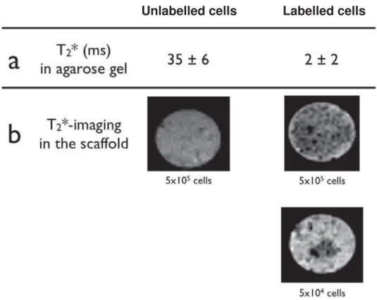 Fig. 5: In vitro MRI analyses of unlabelled and labelled hADSCs.  (a): T2* values obtained for unlabelled and labelled  hADSCs in agarose gel (n=3) 