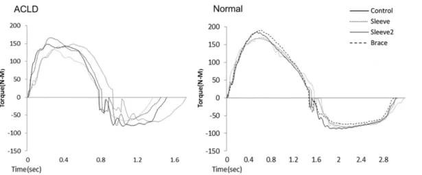 Figure 3. Torque-time curve in 4 conditions of test for extension and flexion at 180 6 .s 21 in an ACLD subject (left) and normal subject (right).