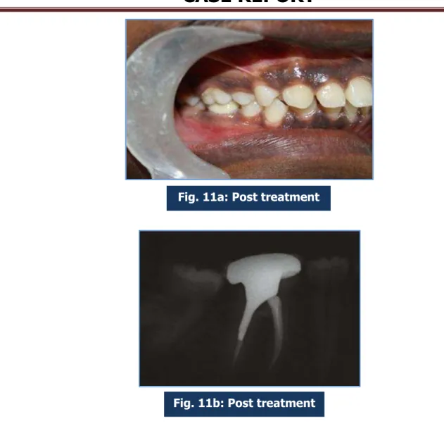 Fig. 11a: Post treatment 