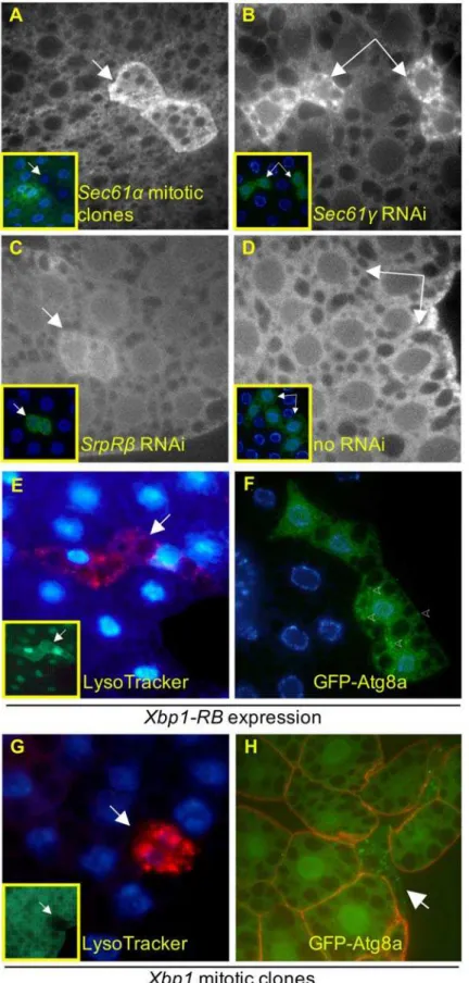 Figure 8. Involvement of the unfolded protein response in lysosomal expansion and autophagy
