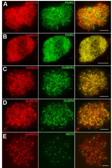 Figure 5. Immunolocalization of several meiotic elements in the Oshus1-1 mutant. (A) PAIR2 signals at zygotene