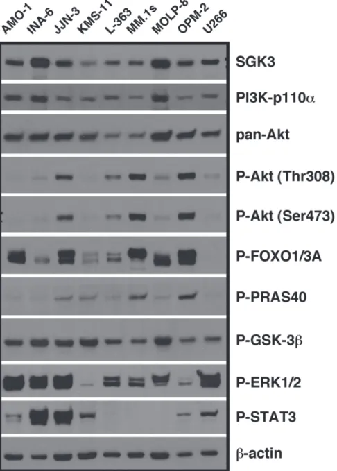 Fig 1. SGK3 expression in relation to (activated) signalling components of the PI3K/Akt system in MM cell lines