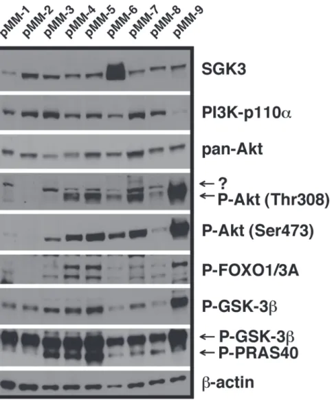 Fig 2. SGK3 expression in relation to (activated) signalling components of the PI3K/Akt system in primary MM cells