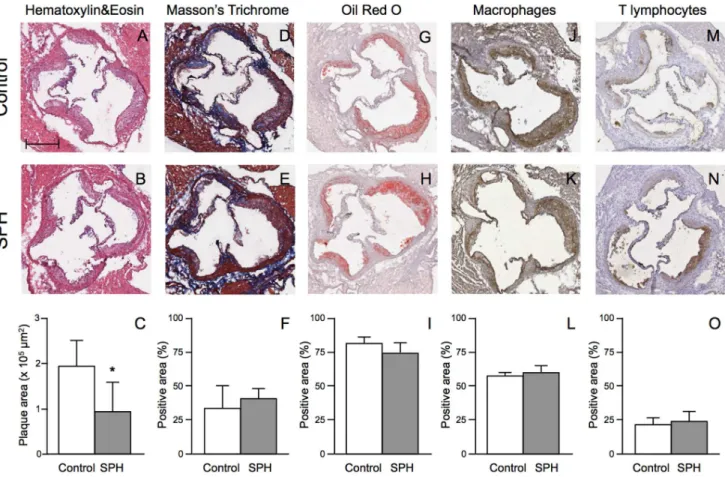 Figure 2. Histological and immunohistochemical characterization of plaques in the aortic sinus in apoE 2/2 mice fed a high-fat diet (control) or a diet with 5% SPH for 12 weeks