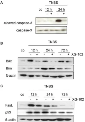 Figure 7. JNK2-Bim co-precipitation. JNK1 and JNK2 immunopre- immunopre-cipitates (IP) from colon tissue homogenates were analyzed by Western blotting with an anti-Bim antibody