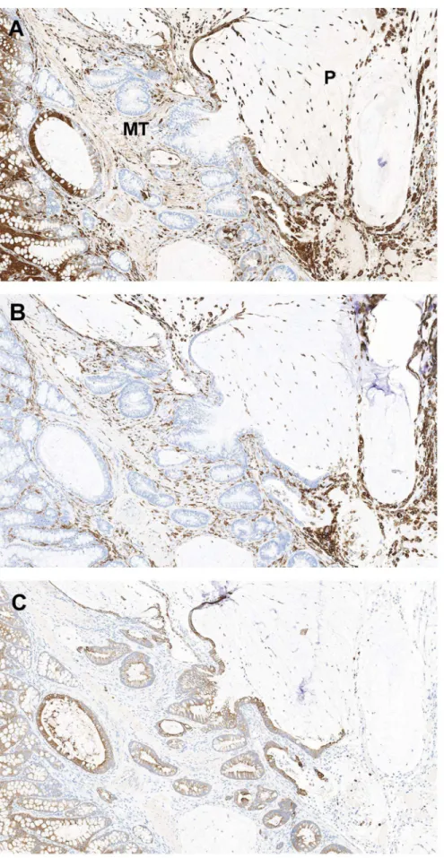 Figure 7. Differential staining patterns between macrophage and epithelial cell markers