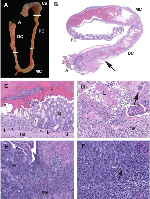 Figure 3. Characteristics of acute typhlocolitis induced by DSS. (A) Smad3 2 / 2 1.5% DSS