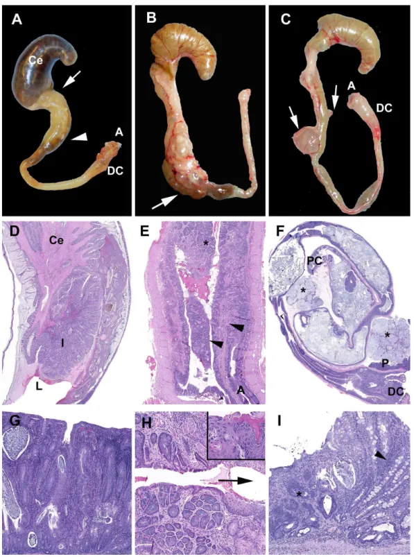 Figure 4. Chronic typhlocolitis and associated secondary lesions induced by DSS. (A–C) Examples of chronic lesions