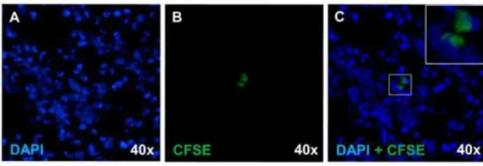 Figure 6. Tracking of CFSE-labeled hAEC. Lung section obtained from mice injected with CFSE-labeled hAEC after MOG immunization and organ collected 7 days later (5 mice for each group, 9–16 sections per organ were examined)