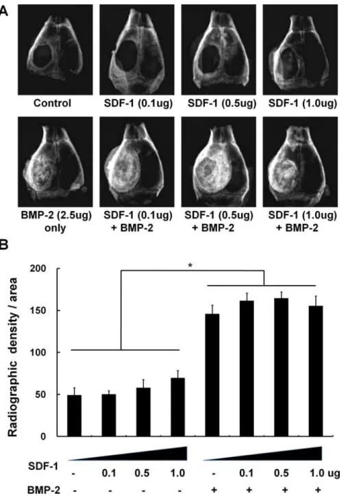 Fig 3. The effect of simultaneous treatment with SDF-1 and BMP-2 on orthotopic bone formation