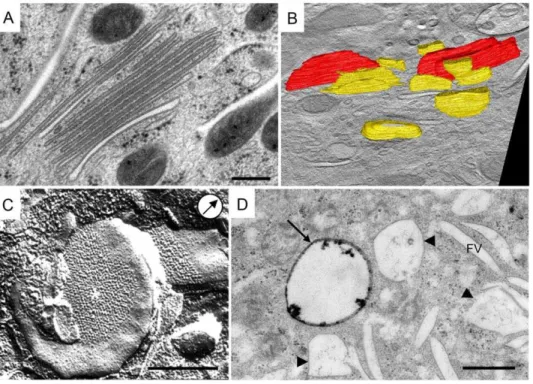 Figure 4. mFVs present the final stage of urothelial plaque formation. A) On the micrograph are shown mFVs organized into a stack