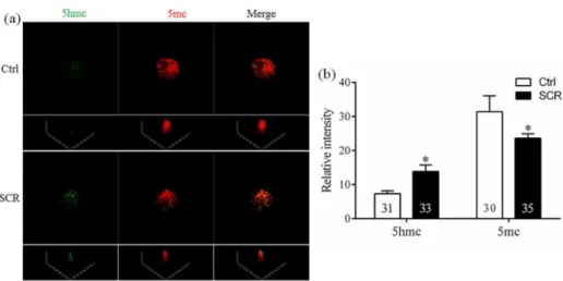 Fig 4. Laser scanning confocal microscopy images (a) and quantification (b) of the relative levels of 5-methylcytosine (5mc) and 5-hydroxymethylcytosine (5hmc) in early embryos at the pronuclear stage, with or without Scriptaid treatment