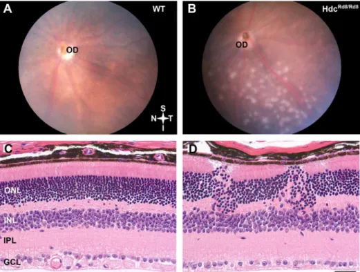 Fig. 2. Hdc rd8/rd8 mice exhibit defects in the outer retina. Retinal fundus images of a three month of WT (A) and Hdc rd8/rd8 mouse retina (B)