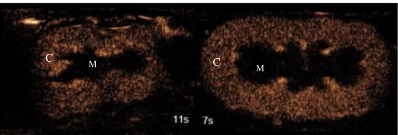 Figura 7. Ultrassonografia contrastada comparativa em rim de gato com doença renal crônica  - DRC (à  esquerda)  e  gato  hígido  (à  direita)